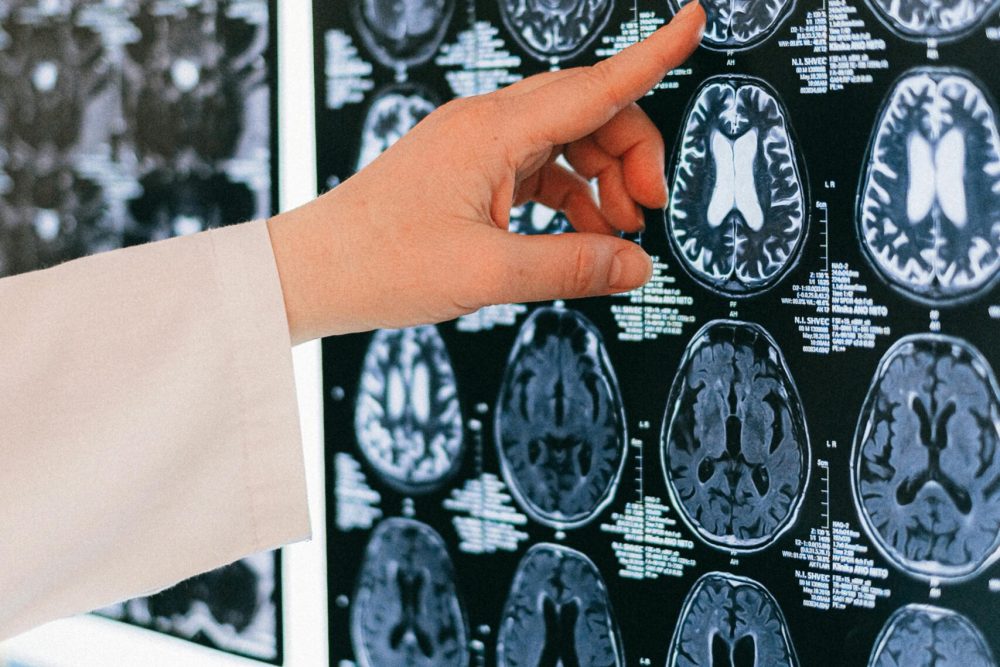 Neurocirujano