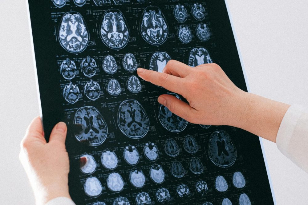 Neurocirujano